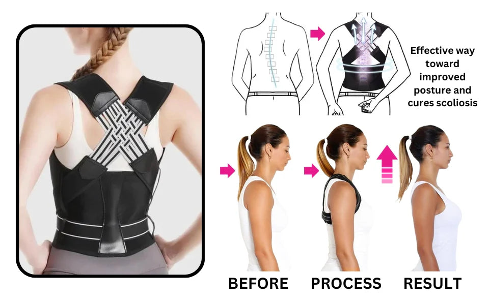 TroveAlign™ – Smart Posture Corrector Belt